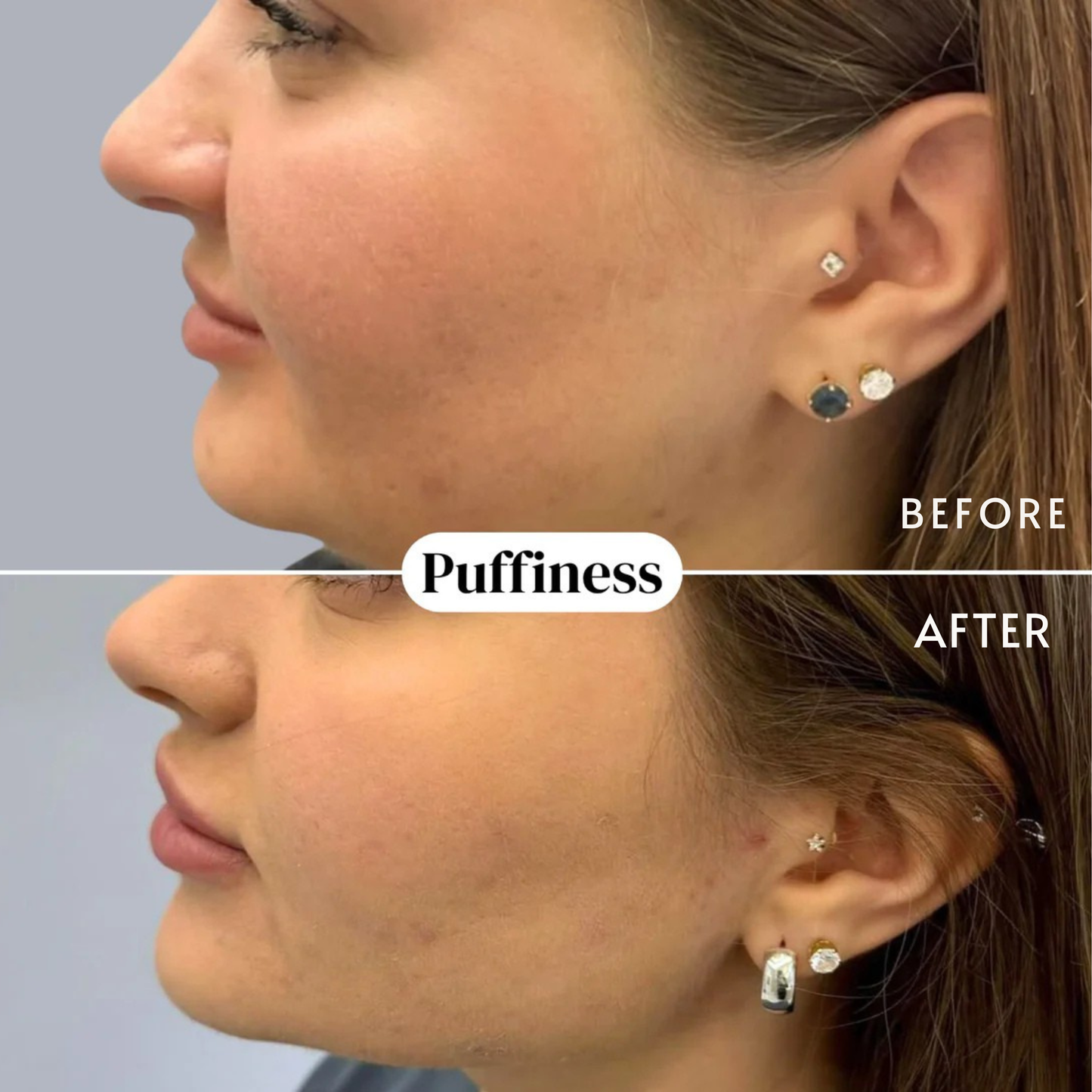 nood - Gotas orgánicas para el drenaje linfático