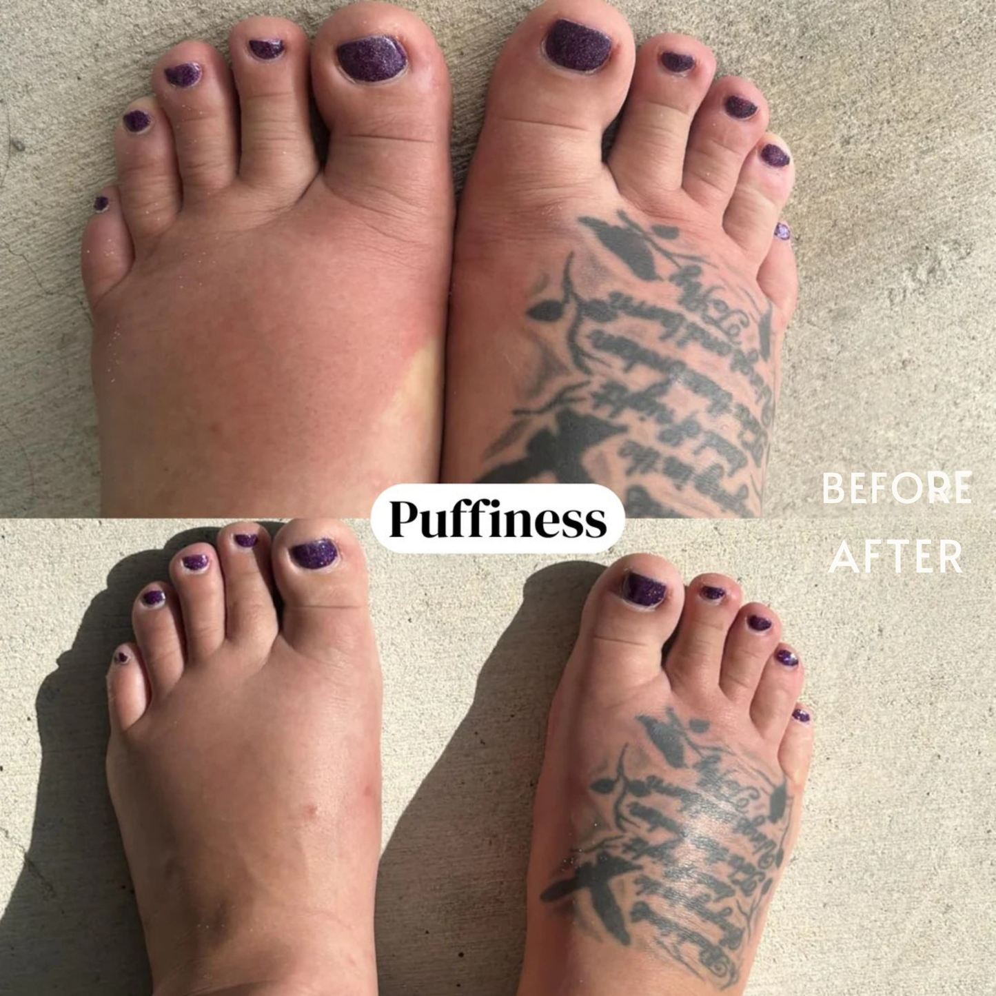 nood - Gotas orgánicas para el drenaje linfático