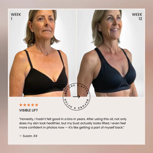 nood - Aceite para levantar el busto