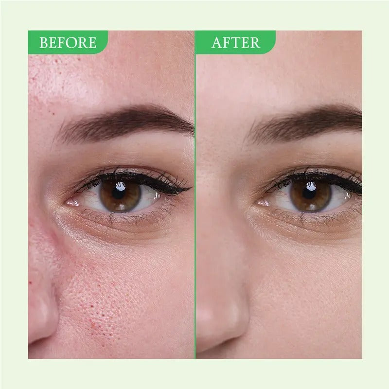 Nood - Mascarilla y limpiador de arcilla verde