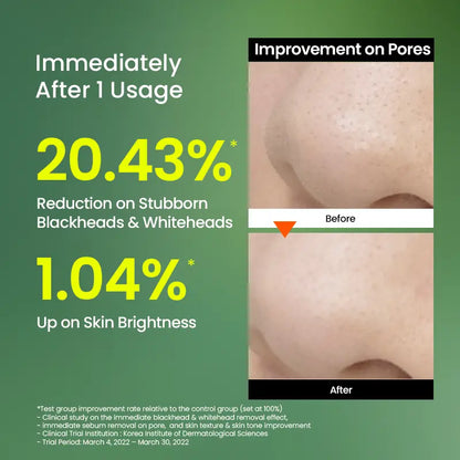 Nood - El trío de poros y brillo número 1 de Corea