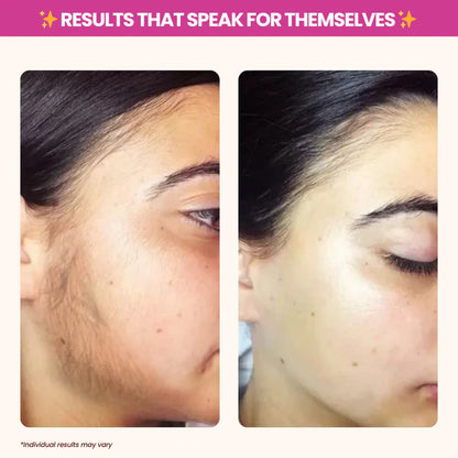 Mascarilla iluminadora de colágeno Nood