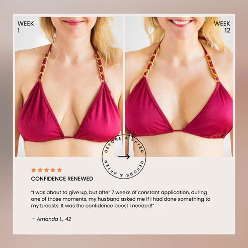 nood - Aceite para levantar el busto