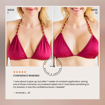 nood - Aceite para levantar el busto